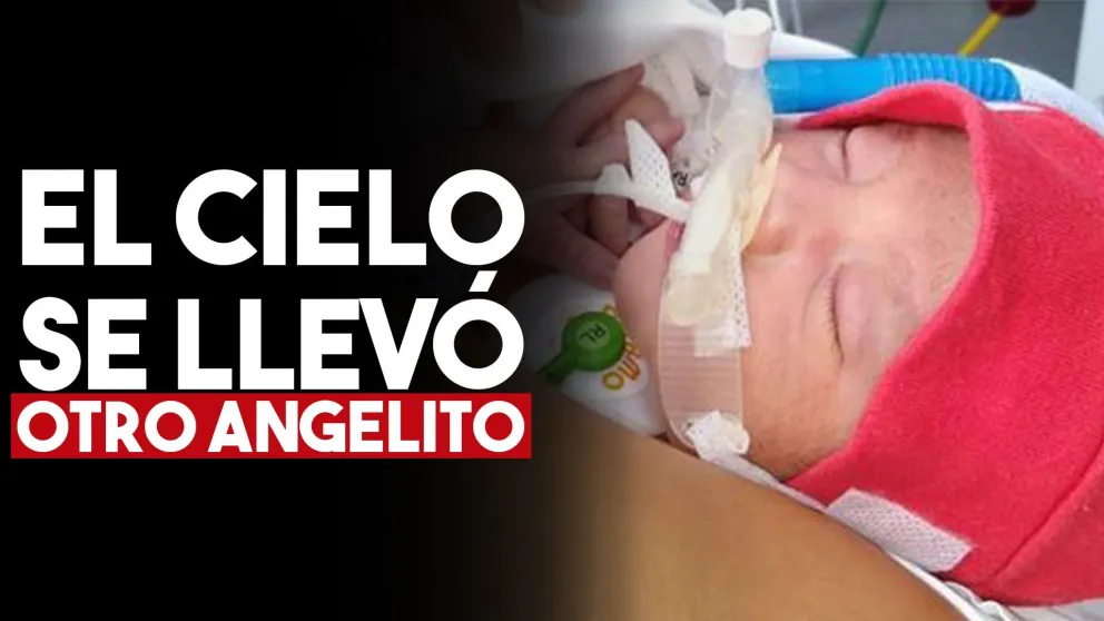 Murió León, el pequeño que fue operado por una malformación cardíaca