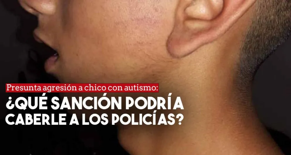 Presunta agresión a un chico  con autismo: ¿Qué sanción le puede caber a los policías?