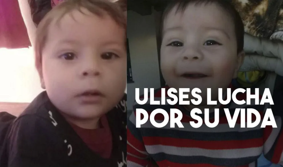 Empeoró el estado de salud de Ulises el pequeño que cayó a una pileta