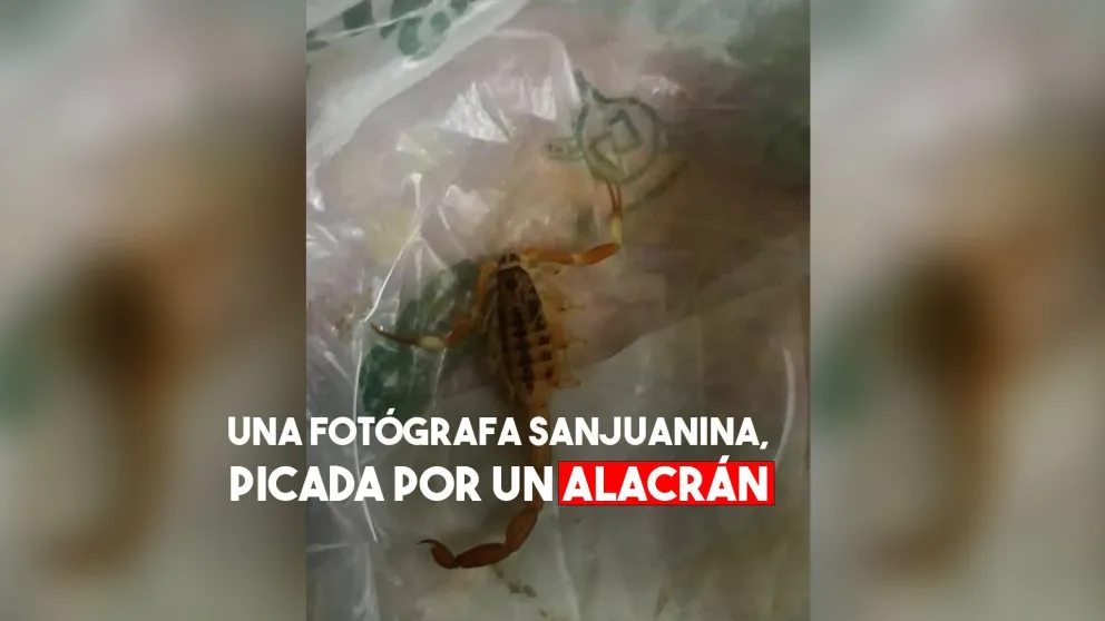 Una fotógrafa sanjuanina fue picada por un alacrán