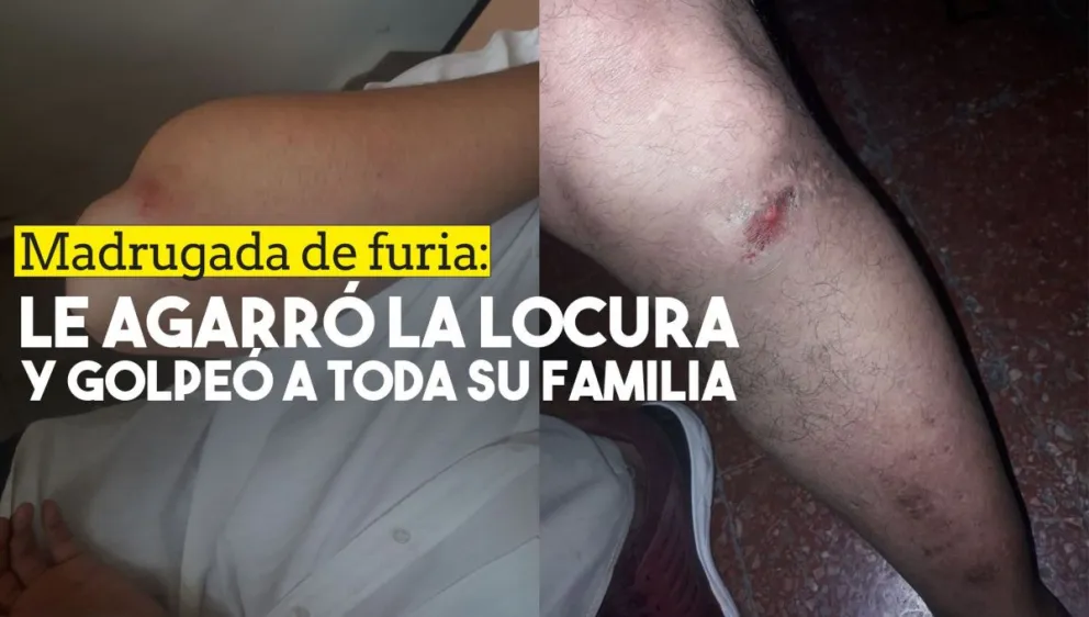 Tuvo un ataque de locura y le dio una paliza a su familia
