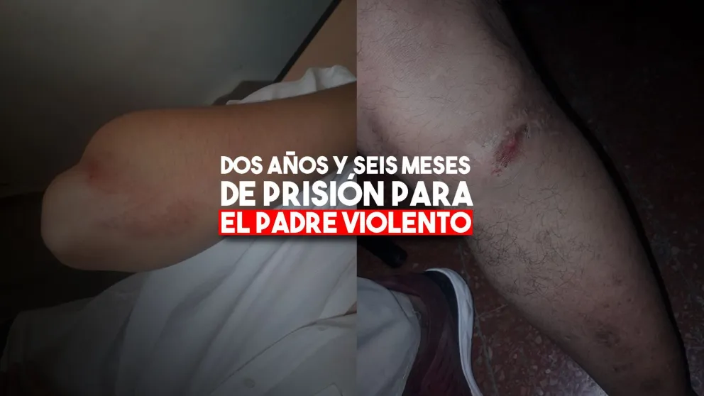 Dos años y medio de prisión para el padre golpeador