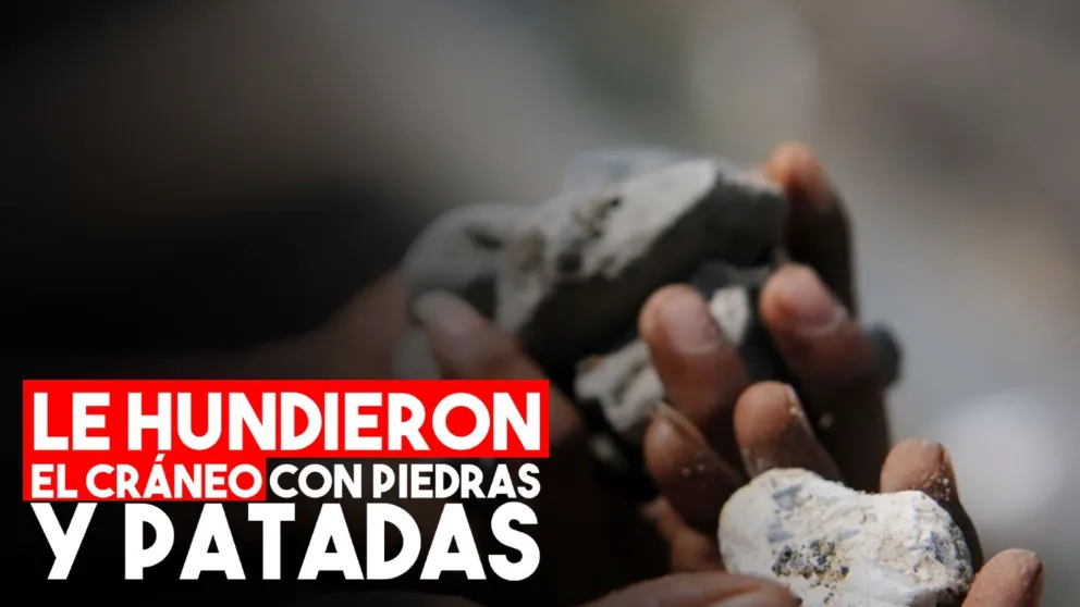 Lo atacaron con piedras y patadas en un presunto intento de robo