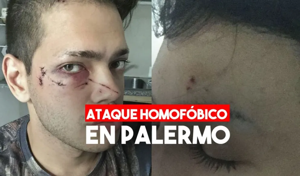 Dos jóvenes fueron agredidos y terminaron en el hospital