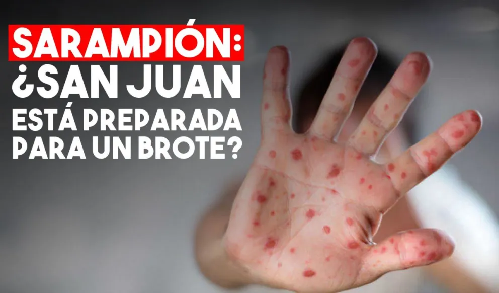 San Juan está preparado para cubrir la vacunación contra el sarampión