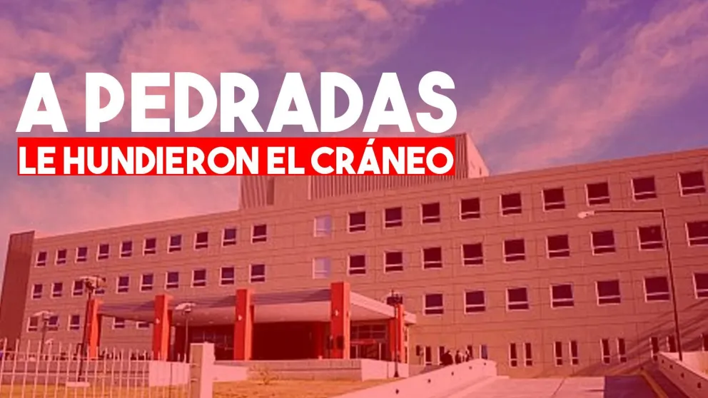Pocito: un hombre terminó con el cráneo hundido por un ataque