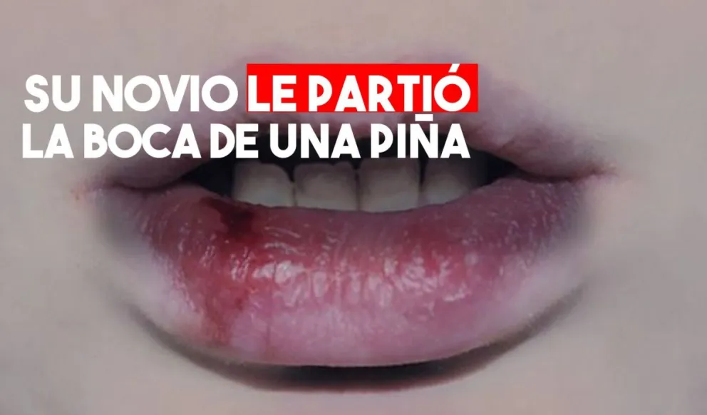 Le rompió la boca de una piña pero no lo denunció