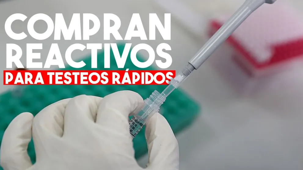 El Gobierno compró 200 mil reactivos para testeos rápidos para investigar la circulación del Covid-19