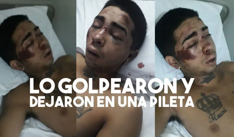 Lo golpearon y tiraron a un pileta pensando que estaba muerto