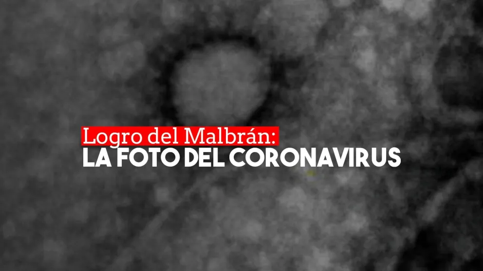 La primera foto del virus SARS-CoV-2 del COVID-19 que circula en Argentina