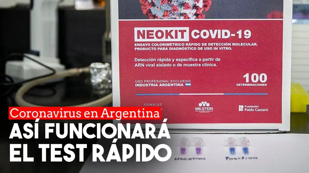Cómo funciona el test de diagnóstico rápido desarrollado por científicos argentinos
