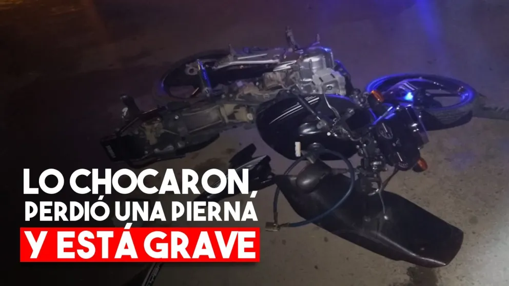 Iba a comprar cigarrillos, lo chocaron y perdió una pierna