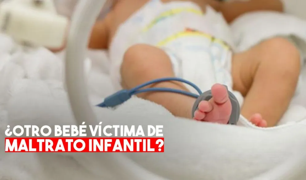 Investigan si golpearon a un bebé de Jáchal que sufrió fractura de cráneo