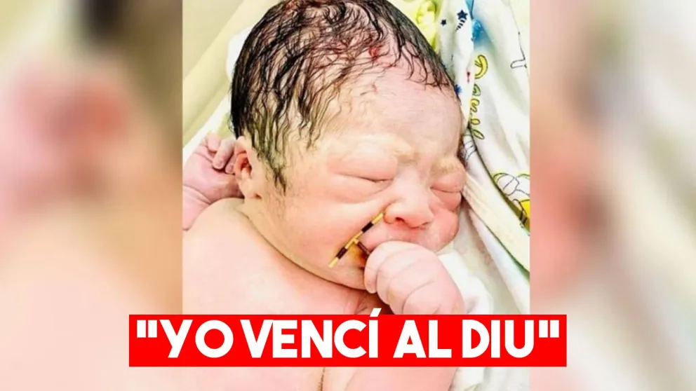 En Vietnam un bebé nació con el DIU en la mano