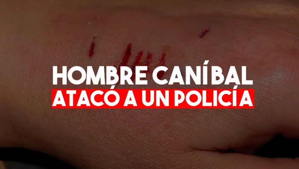 Detuvieron a un sujeto por morder a un policía