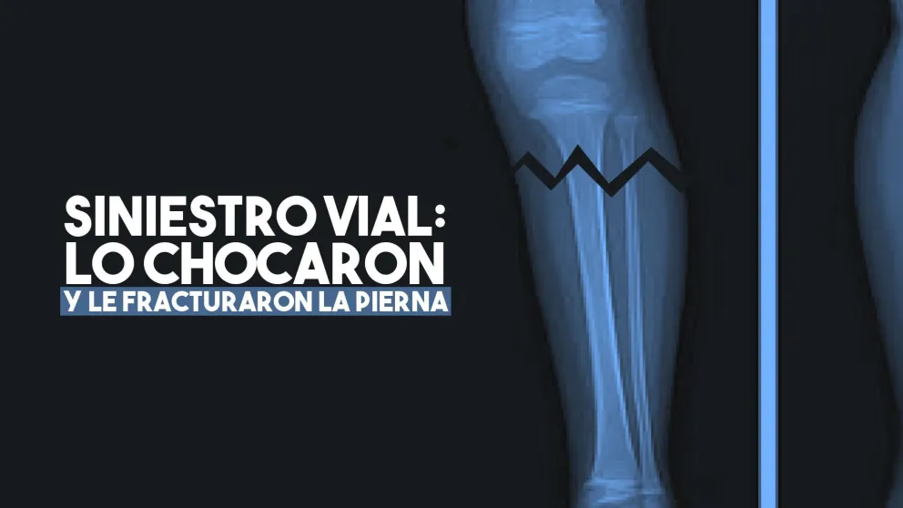 Pasó un semáforo en rojo y atropelló a dos motociclistas