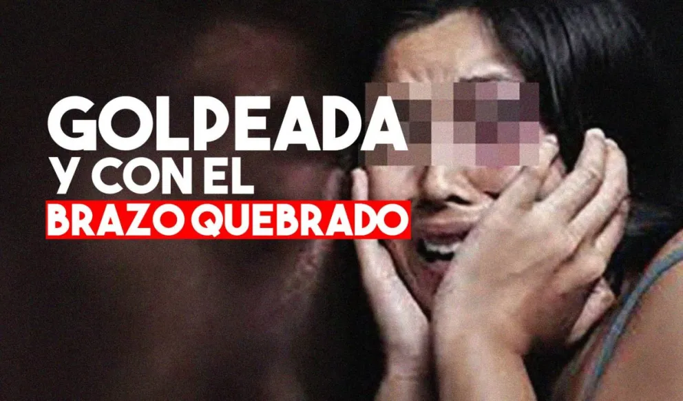 Golpearon a un mujer y le quebraron el brazo