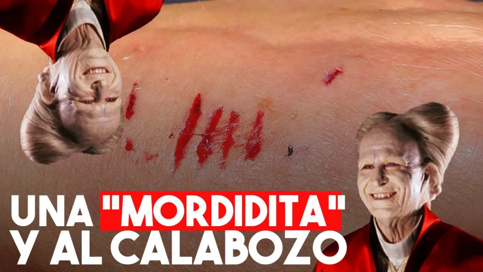Una mujer detenida por morderle la mano a un policía
