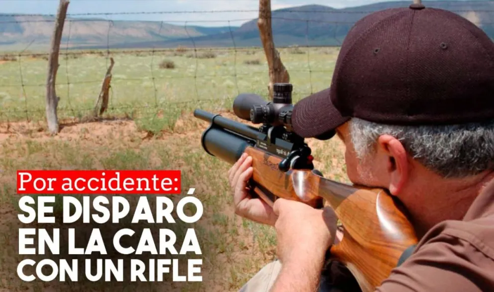 Se disparó en la cara con un rifle y quedó en grave estado