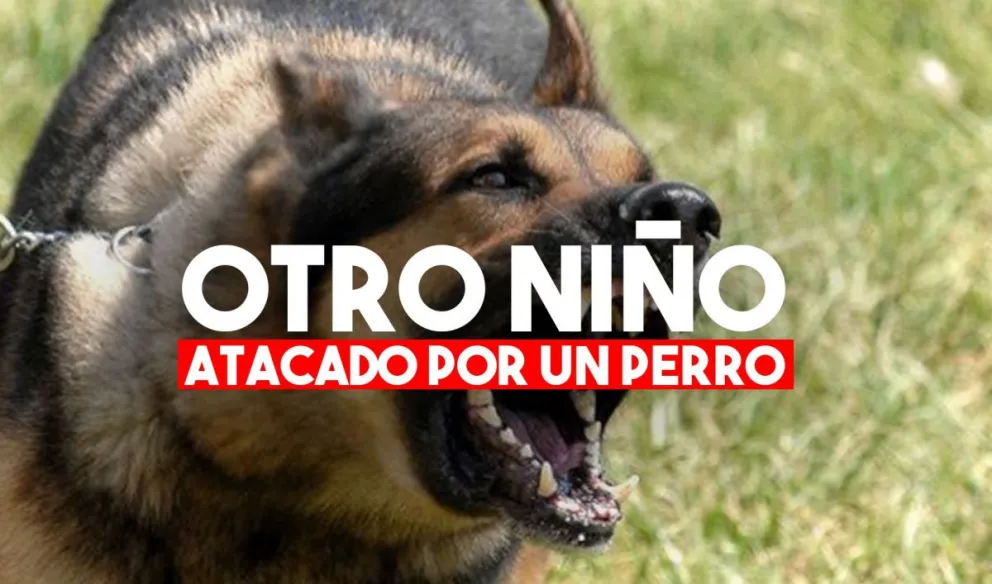 La Bebida: un niño de dos años fue mordido por un perro en su cara