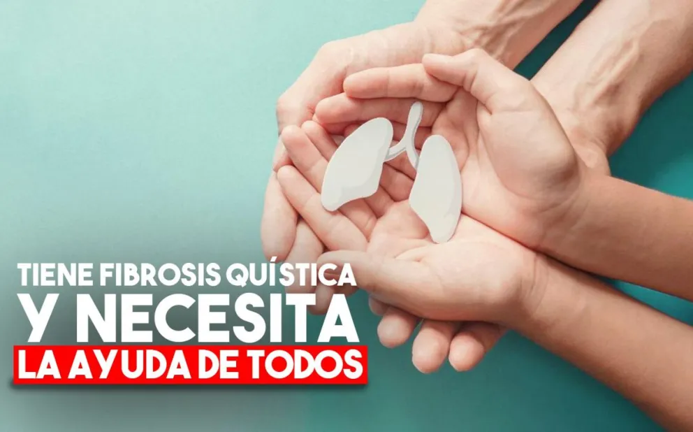 Le diagnosticaron fibrosis quística y necesita ayuda para el tratamiento