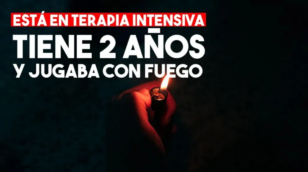 Un nene de 2 años se quemó el 30% de su cuerpo