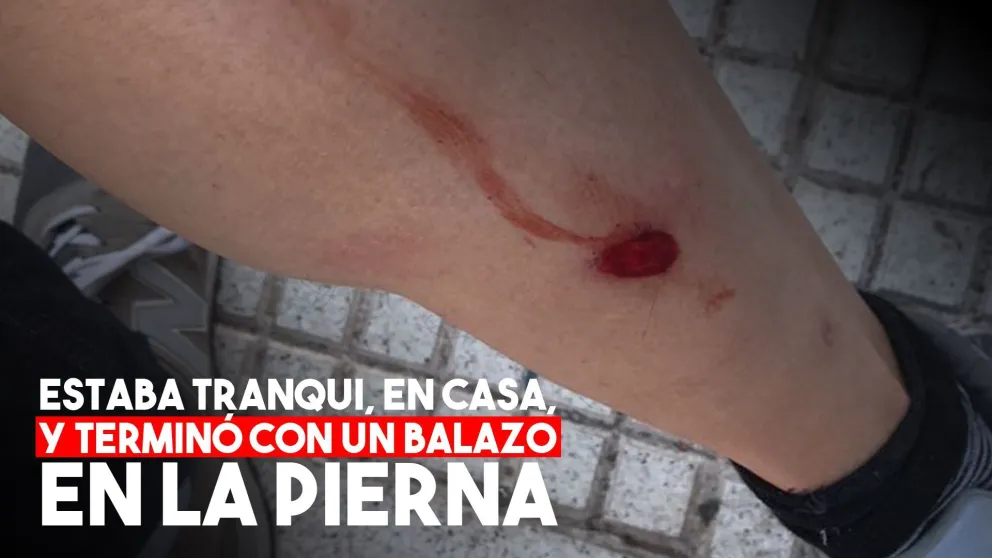 Le balearon la casa y terminó herido
