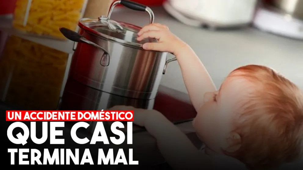 Un niño de 2 años terminó internado tras quemarse con agua hirviendo