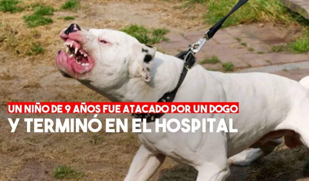 Un Dogo atacó a un niño de 9 años mientras jugaba
