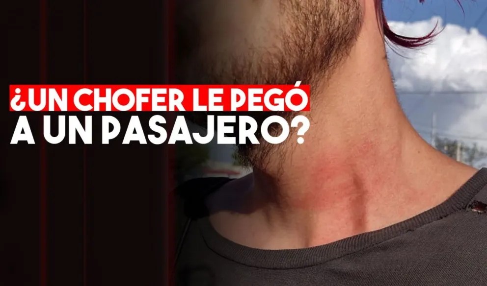 El escrache de un músico sanjuanino a un chofer: insultos forcejeo y golpes