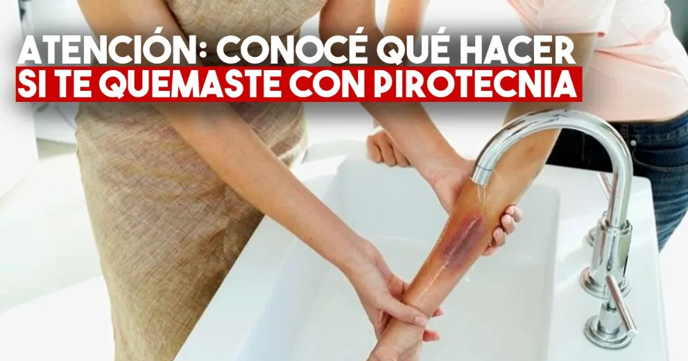 Esto es lo que debés hacer y lo que no en caso de quemadura con pirotecnia