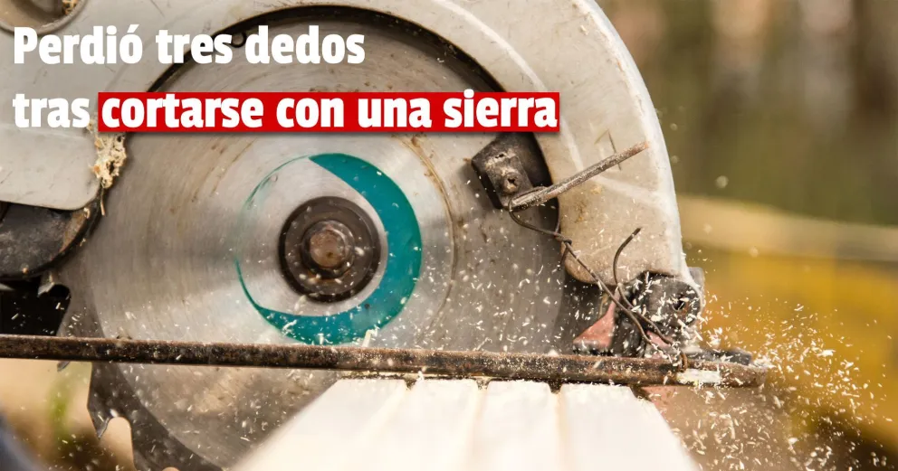 Trabajaba en su carpintería y en un accidente se cortó tres dedos