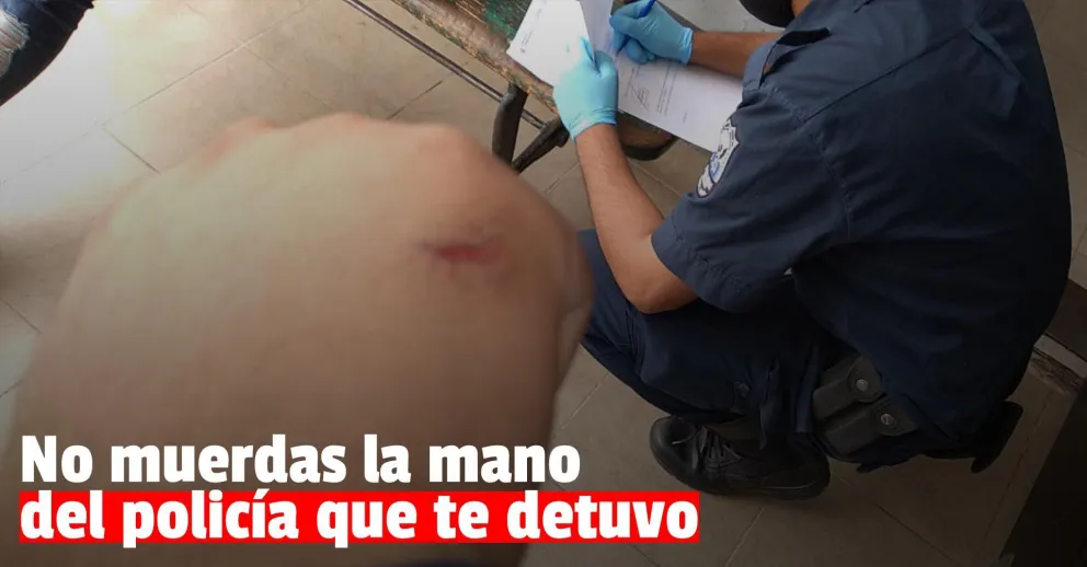 Una pelea interbarrial terminó con un policía mordido y herido