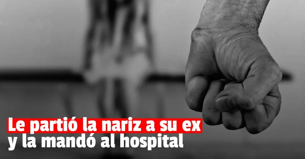 Fue a buscar a su hijo y el padre del menor le rompió la cara