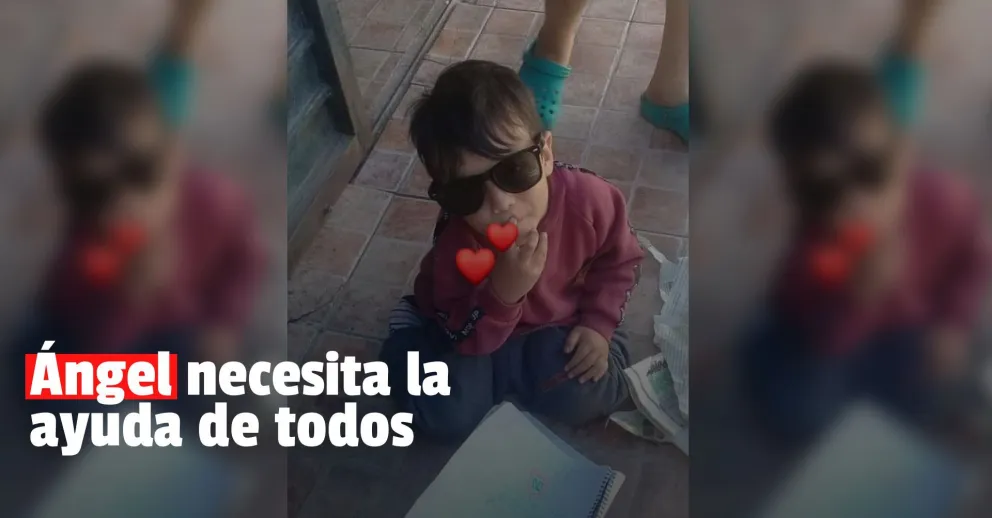 Tiene dos quistes en la cabeza y necesitan recaudar dinero para costosos estudios