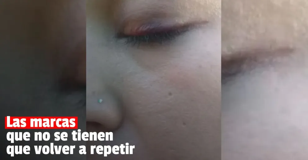 Así quedó la mujer que fue golpeada por su pareja en 9 de Julio
