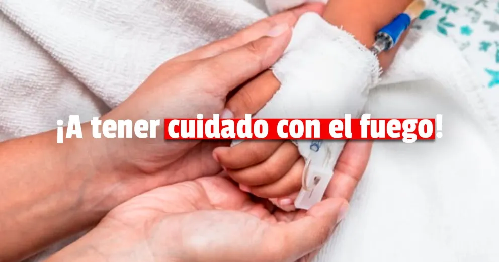 Accidentes domésticos en invierno: el 85% de los quemados son niños entre 0 a 12 años