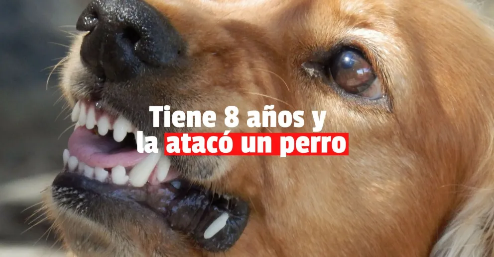 Una nena recibió mordidas de un perro en su cara