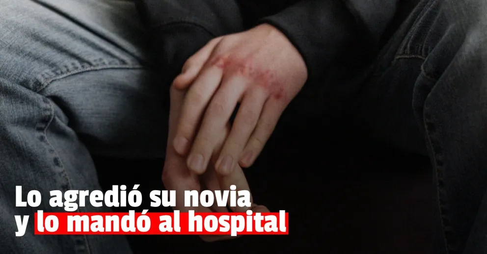 Una joven agredió a su pareja y le dejó cortes en el cuerpo