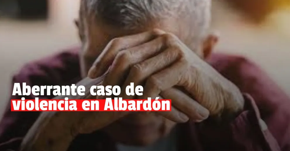Albardón: una mujer roció con alcohol a su ex pareja y le tiró un fósforo encendido