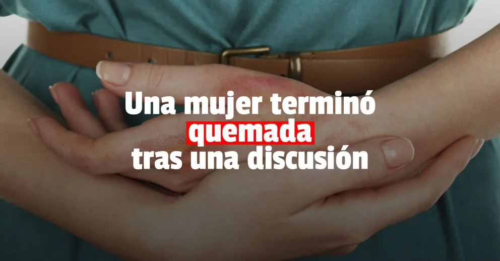 Discutió con su pareja y terminó con el cuerpo quemado