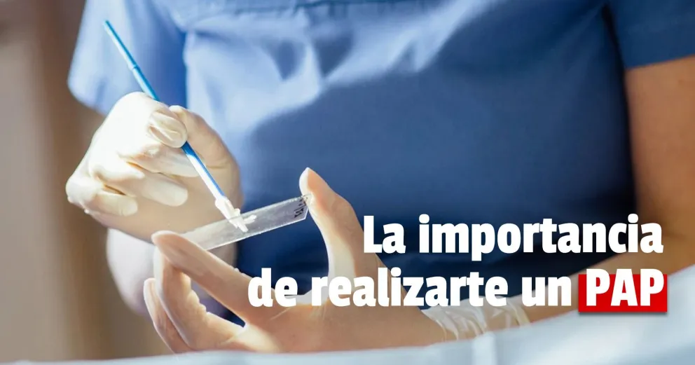 Cáncer de cuello uterino: la importancia de realizarse un PAP ginecológico