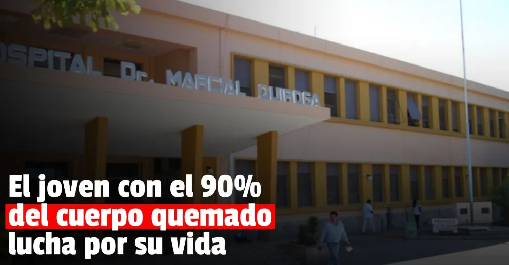 El joven que resultó quemado en la explosión está gravísimo