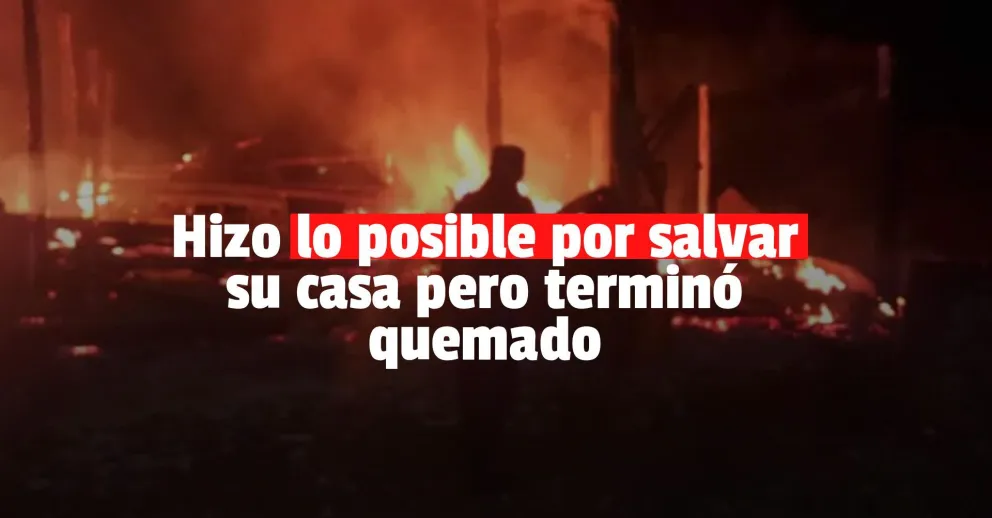 Un hombre sufrió graves quemaduras tras intentar apagar un incendio en su casa
