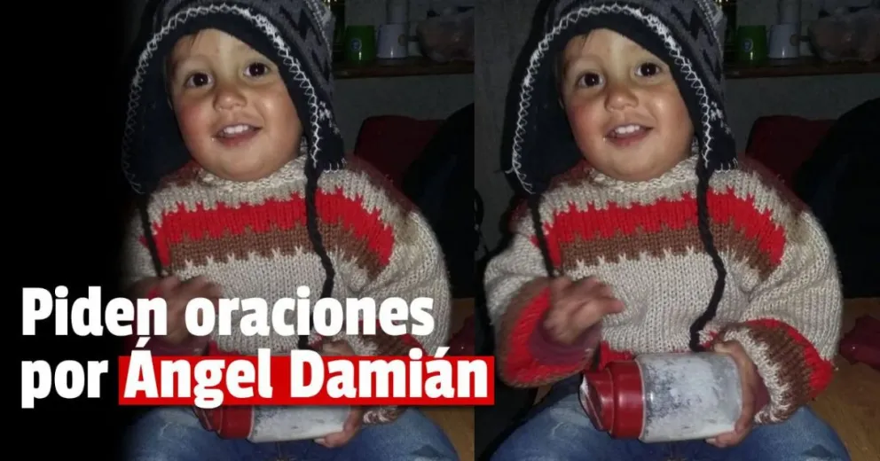 Piden cadenas de oraciones por el nene que sufrió graves quemaduras con aceite hirviendo