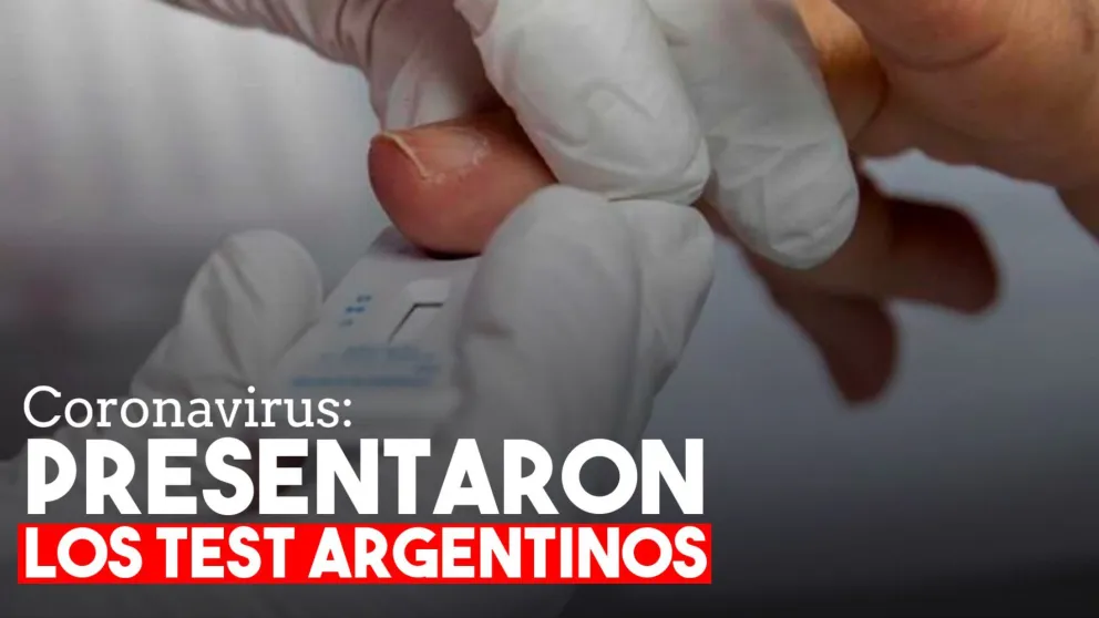 El Gobierno presentó test rápidos de COVID-19 fabricados en el país