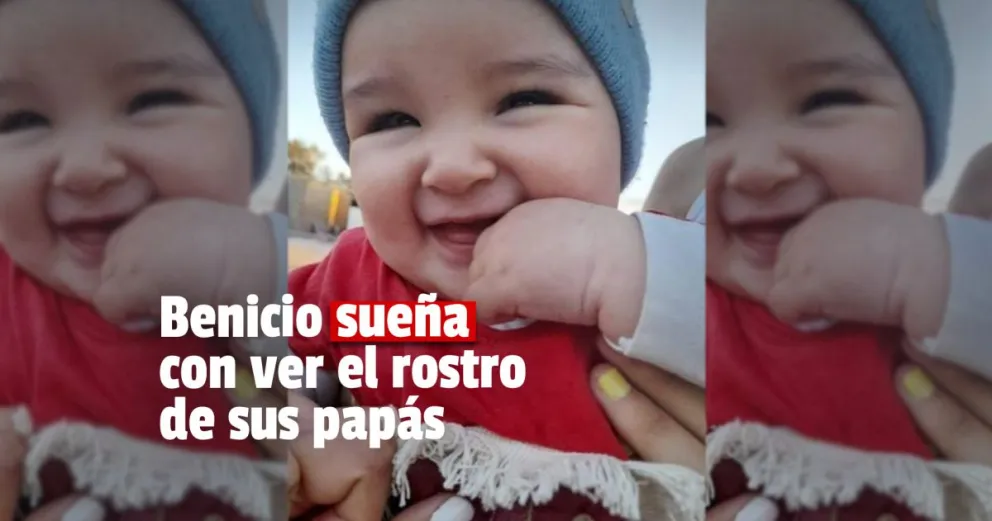 Benicio tiene 6 meses y padece desprendimiento de retina, su familia busca que pueda ver