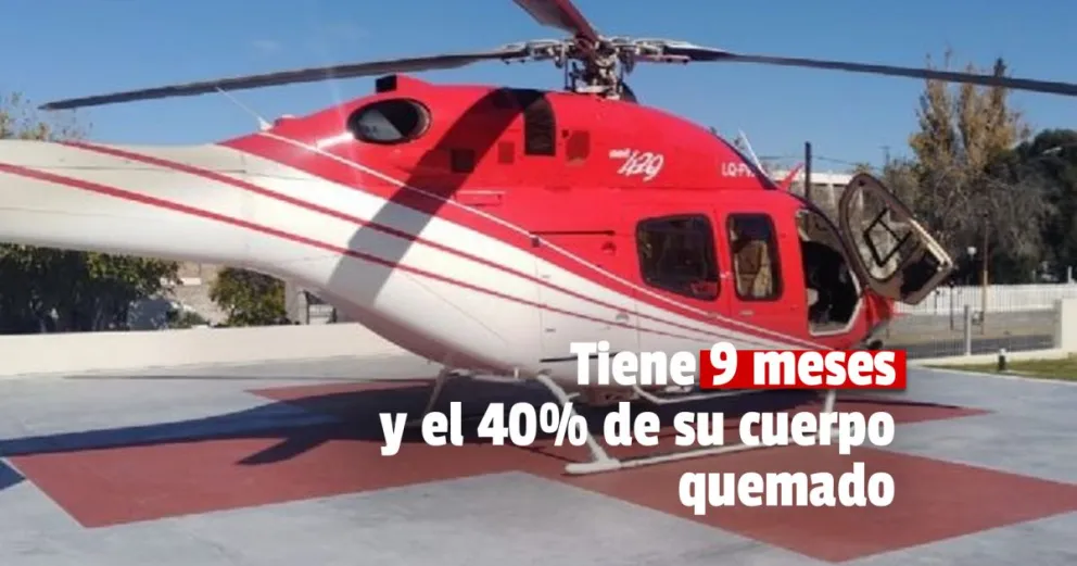 Rodeo: un bebé sufrió graves quemaduras en su cuerpo y debió ser trasladado en vuelo sanitario