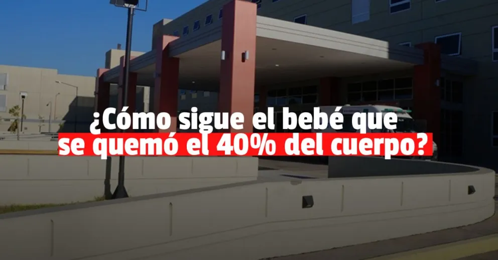 Evoluciona favorablemente el bebé que se quemó el 40% del cuerpo 