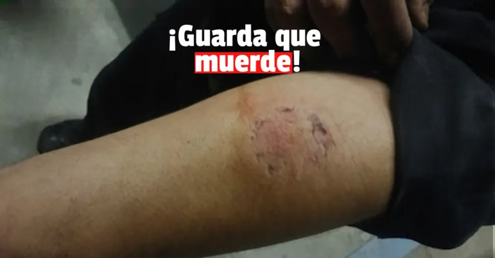 Discutió con su esposa y la atacó a mordiscos